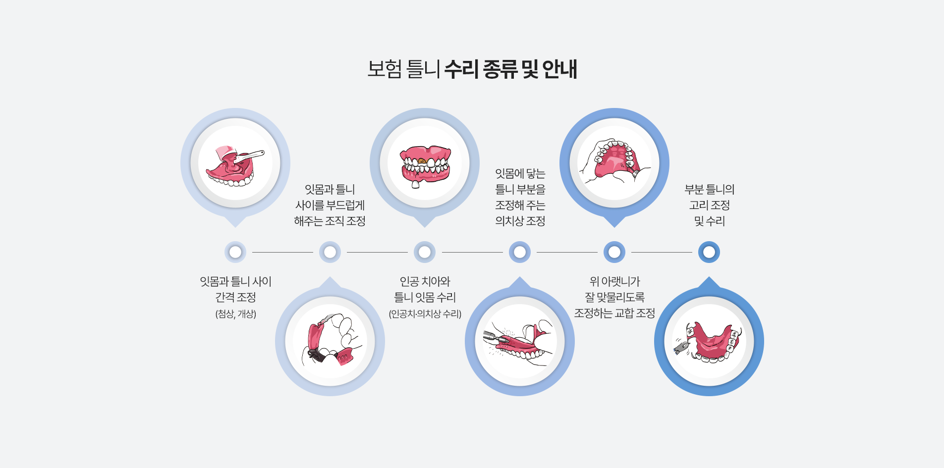 보험 틀니 수리 종류 및 안내