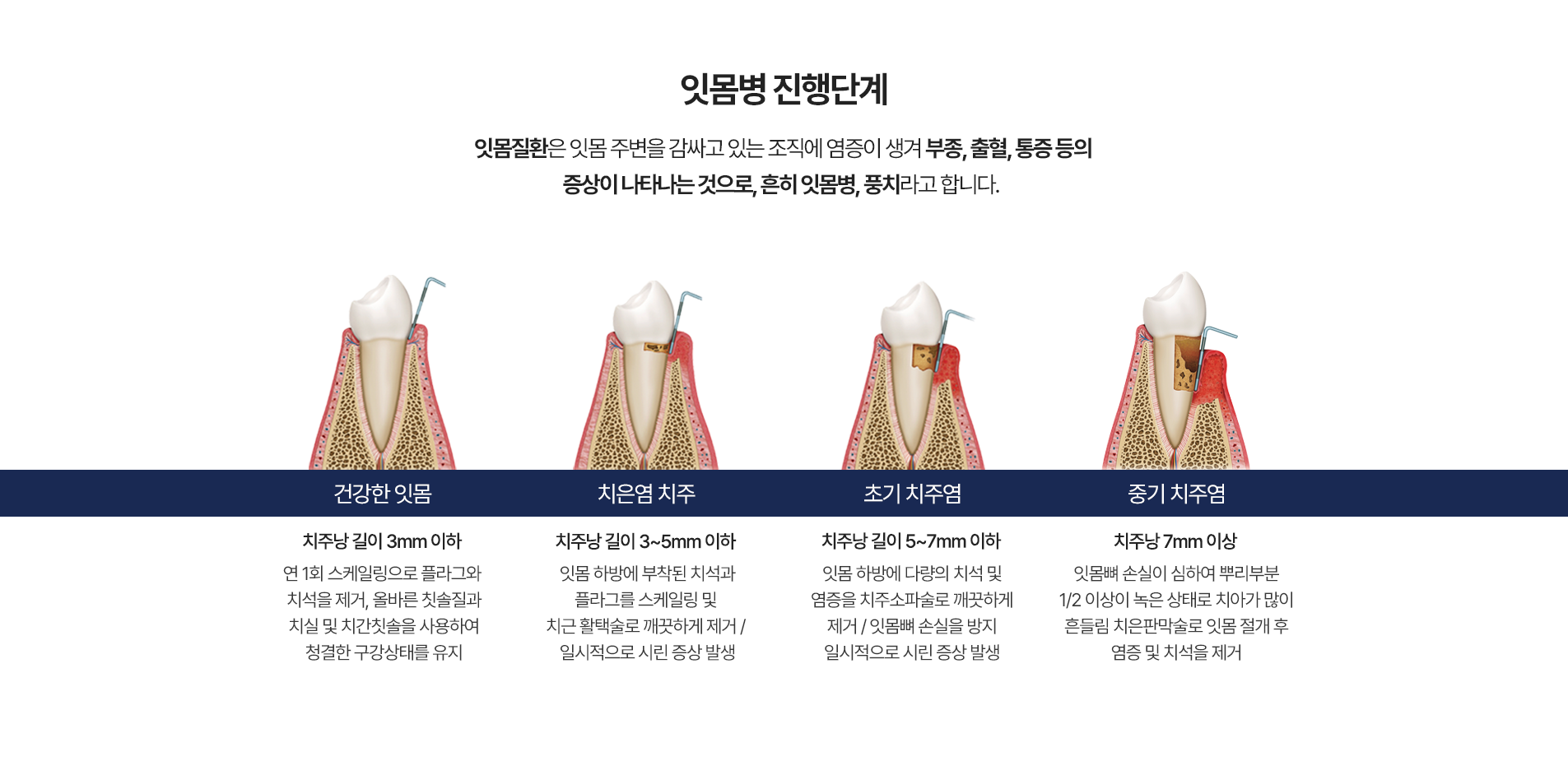 잇몸병 진행단계