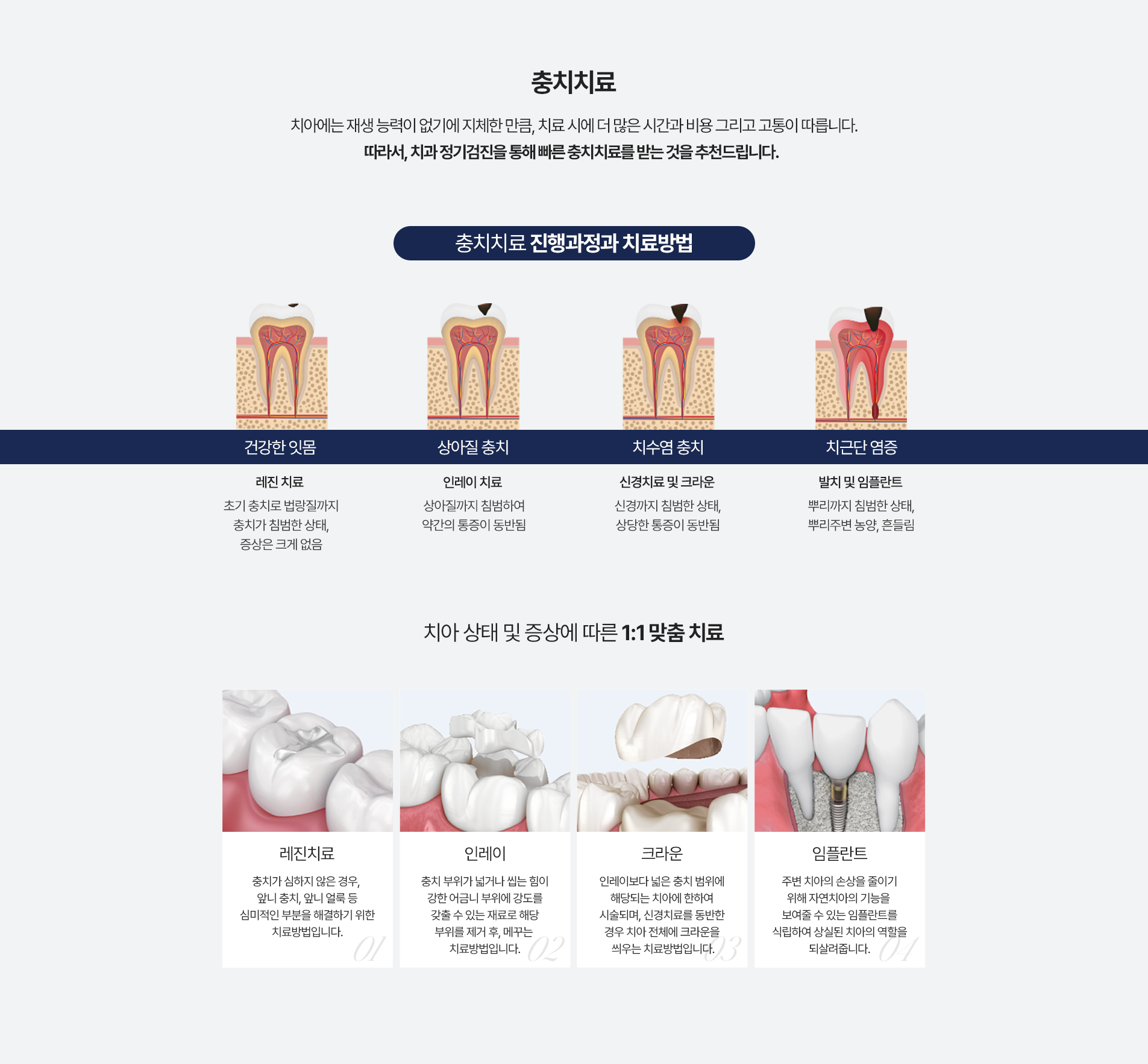 충치치료
