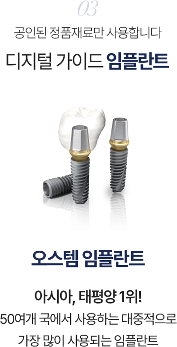 디지털 가이드 임플란트