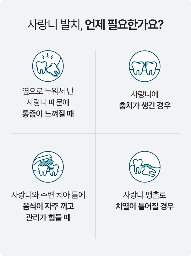 사랑니 발치 시기