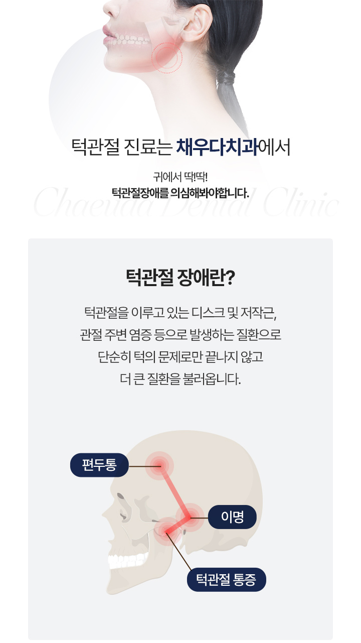 턱관절 물리치료